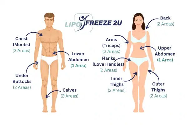 Areas you can have fat freezing treatment Bere Regis