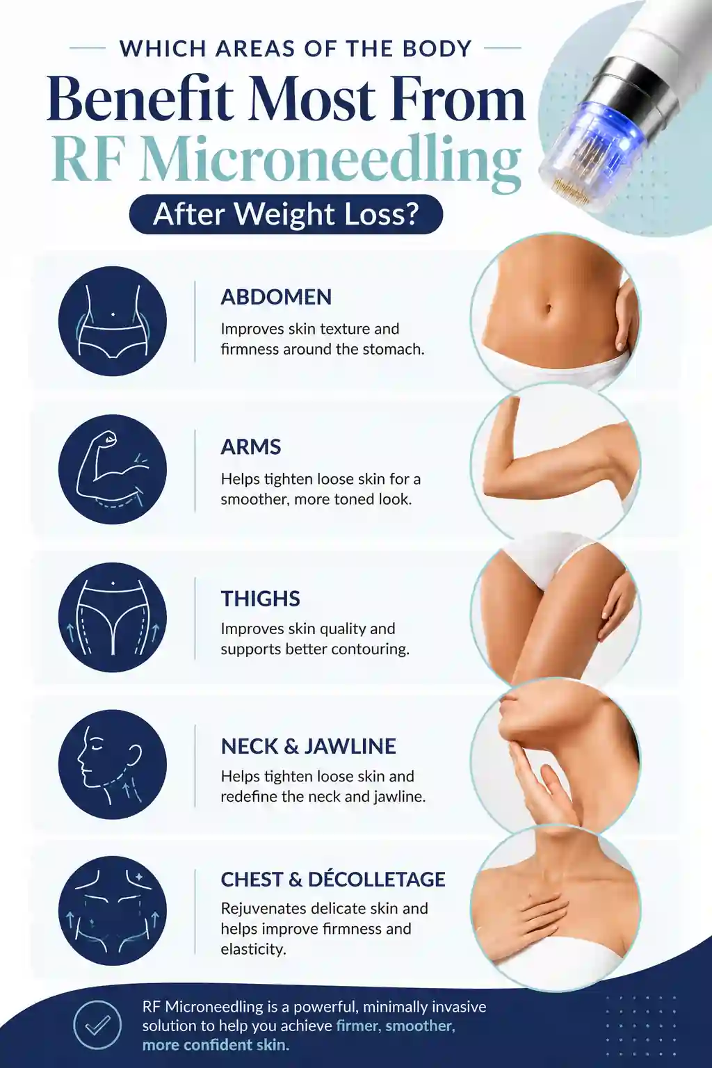 Which Areas of the Body Benefit Most From RF Microneedling After Weight Loss Bere Regis